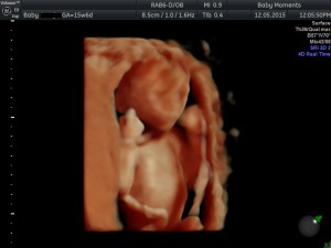 16 wks baby scan wiltshire